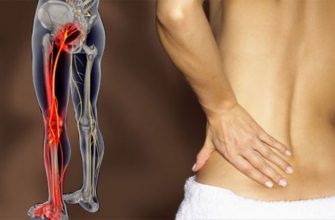 2 простых способа разблокировать седалищный нерв и быстро снять боль!