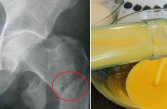 Она употребляла 1 столовую ложку этого средства 3 раза в день. То, что произошло через месяц, восхищает!