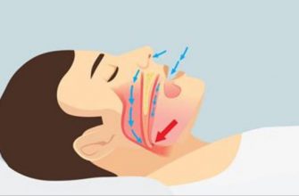 Почему мы храпим и как перестать