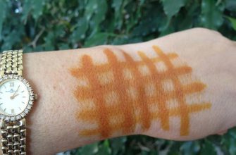 Магическая йодная сетка от различных болезней