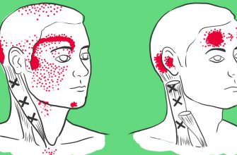 Нехватка этих продуктов вызывает головную боль. Жаль, что не знала об этом раньше!