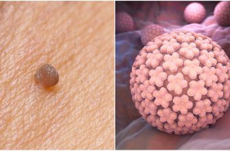 В борьбе с коварным врагом хороши любые методы. Действенные лекарства с полей и огородов!