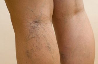 Не давай лимфе застаиваться! Если ноги отекают, важно не допустить губительной ошибки.