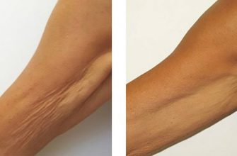 Морщинистая шея, дряблые руки и рыхлые бедра в прошлом! Это средство огорчит пластических хирургов.