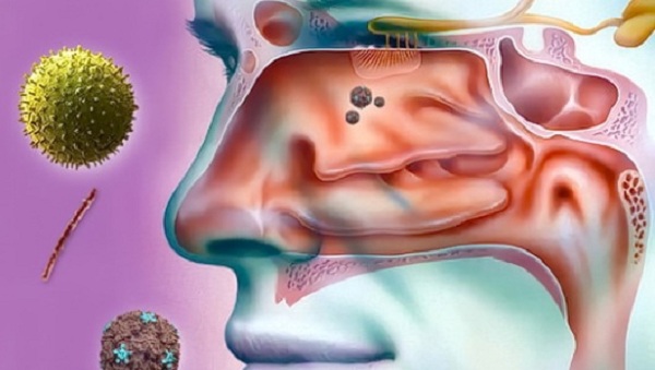 Проблема заложенности вашего носа в кишечнике