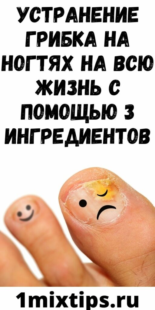 УСТРАНЕНИЕ ГРИБКА НА НОГТЯХ НА ВСЮ ЖИЗНЬ С ПОМОЩЬЮ 3 ИНГРЕДИЕНТОВ