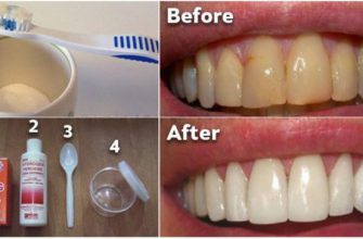 Как избавиться от зубного налета и отбеливать зубы без дорогостоящих процедур. Вам понравится это средство!