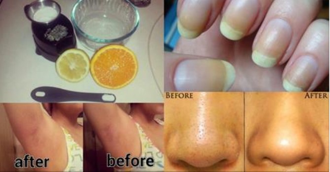 7 отличных методов применения лимона для красоты! Всегда держу в холодильнике