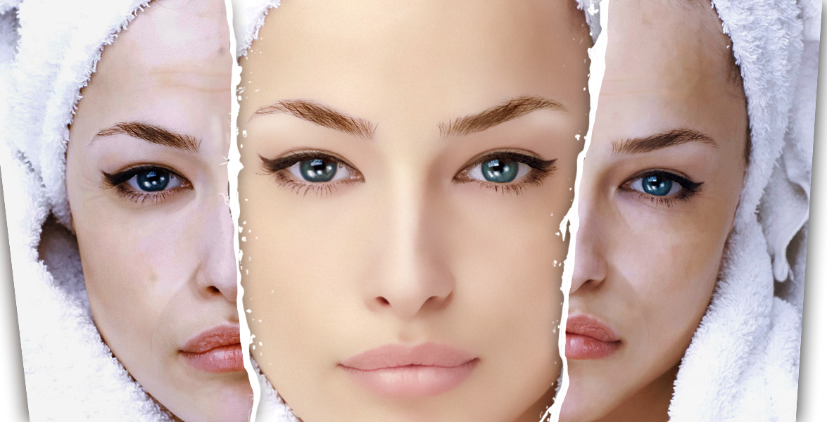 Как быстрее разгладить морщинки вокруг глаз? Эффективные маски, важные правила и маленькие хитрости