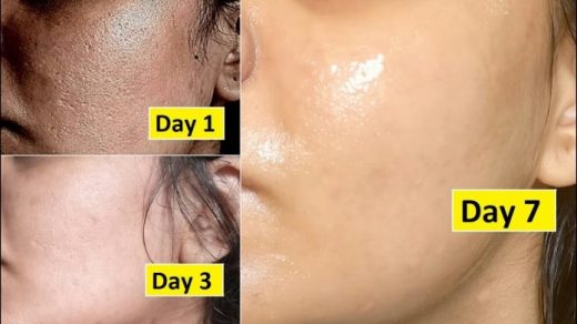 3 дневная процедура: ваша кожа будет выглядеть на 10 лет моложе
