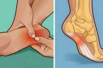 МОЛОЧНАЯ СЫВОРОТКА: «ПОРХАЮ», КАК В МОЛОДОСТИ. УЖЕ 10 ЛЕТ КАК НОГИ НЕ БОЛЯТ