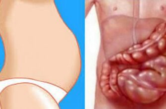 Ты не толстая, всему виной неправильное питание и вздутие живота! Рецепт