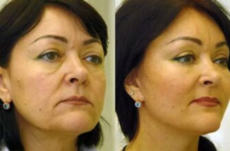 Этот старинный метод омоложения и подтяжки лица подруга привезла из Японии.. Пять дней и вы не узнаете себя в зеркале!