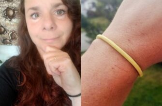 Девушка всегда носила на руке резинку для волос и через 30 лет пожалела об этом