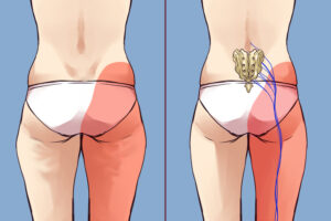 8 упражнений, которые спасут от застоя лимфы из-за сидячего образа жизни 8 упражнений, которые спасут от застоя лимфы из-за сидячего образа жизни