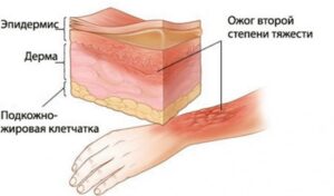 5 самых сильных из существующих видов боли 5 самых сильных из существующих видов боли