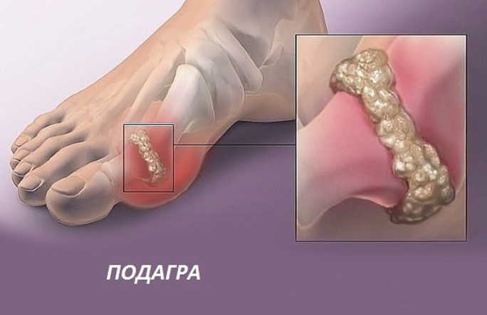 Упражнения